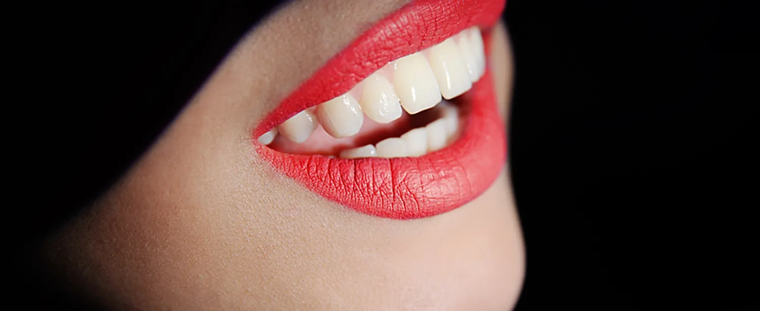 Teeth Whitening , Safe Teeth Whitening in Mortsel
