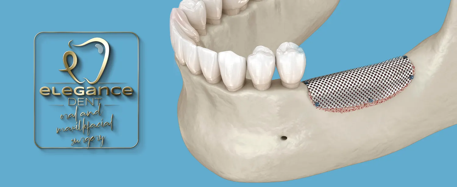 Mondchirurgie , Mondchirurgie In Mortsel België , Oral and maxillofacial surgery , oral surgery , maxillofacial surgery , oral surgery in Mortsel