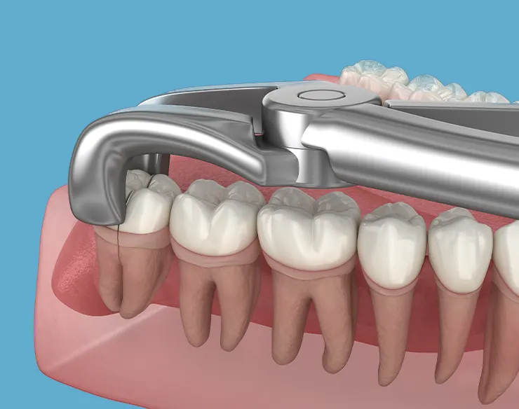 Oral and maxillofacial surgery , oral surgery , maxillofacial surgery , oral surgery in Mortsel