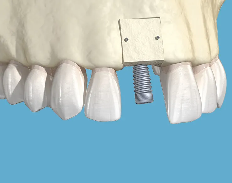 Oral and maxillofacial surgery , oral surgery , maxillofacial surgery , oral surgery in Mortsel