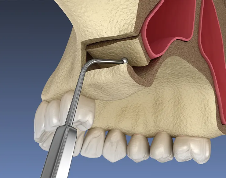 Oral and maxillofacial surgery , oral surgery , maxillofacial surgery , oral surgery in Mortsel