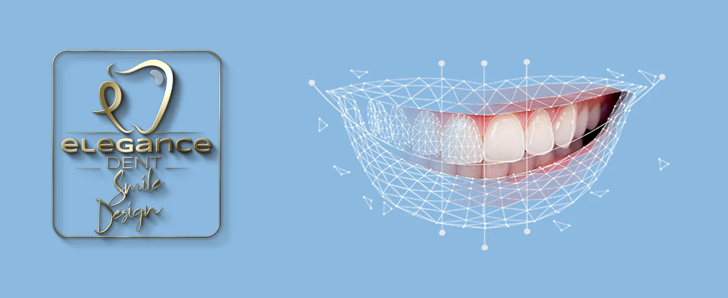 Smile design , smile design Mortsel